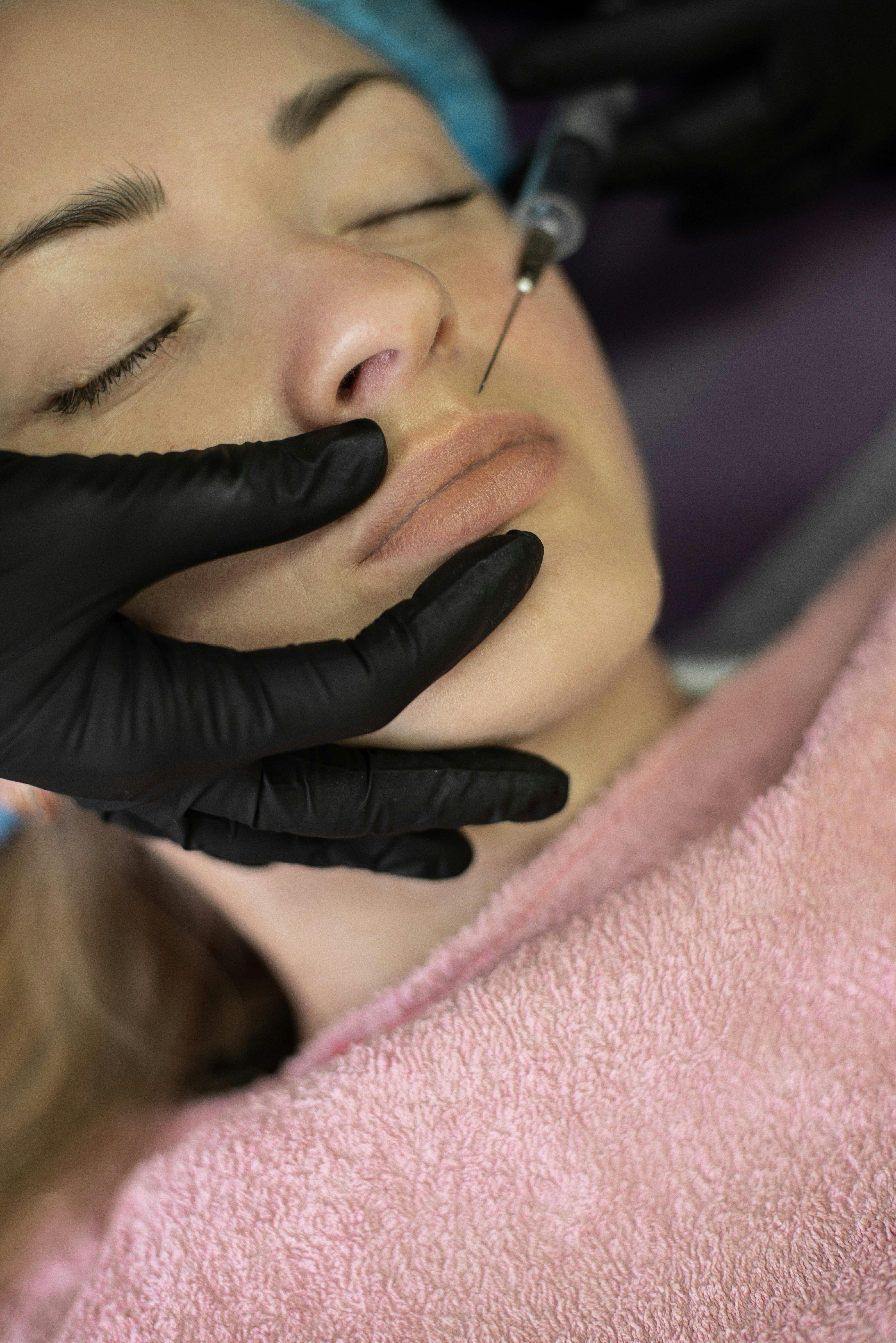 Filler Treatments